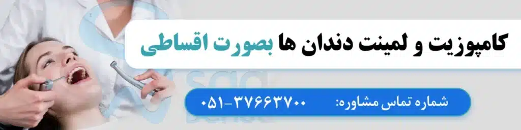 قیمت کامپوزیت دندان در مشهد